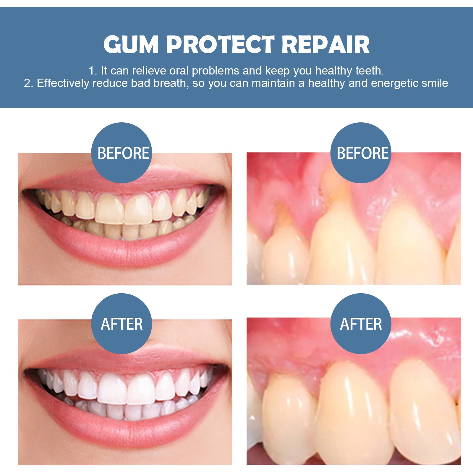 Gum Repair Series Cleaning Tooth Stains - Image 4