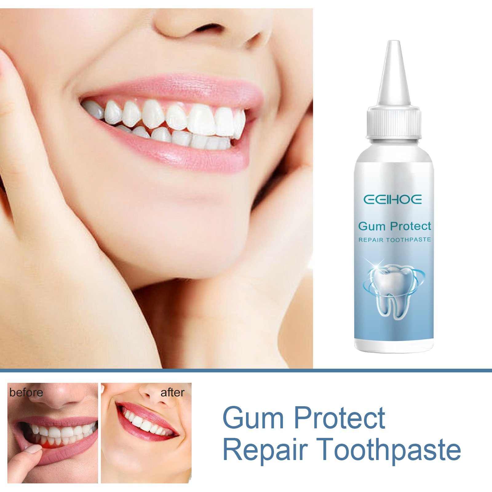 Gum Repair Series Cleaning Tooth Stains - Image 3